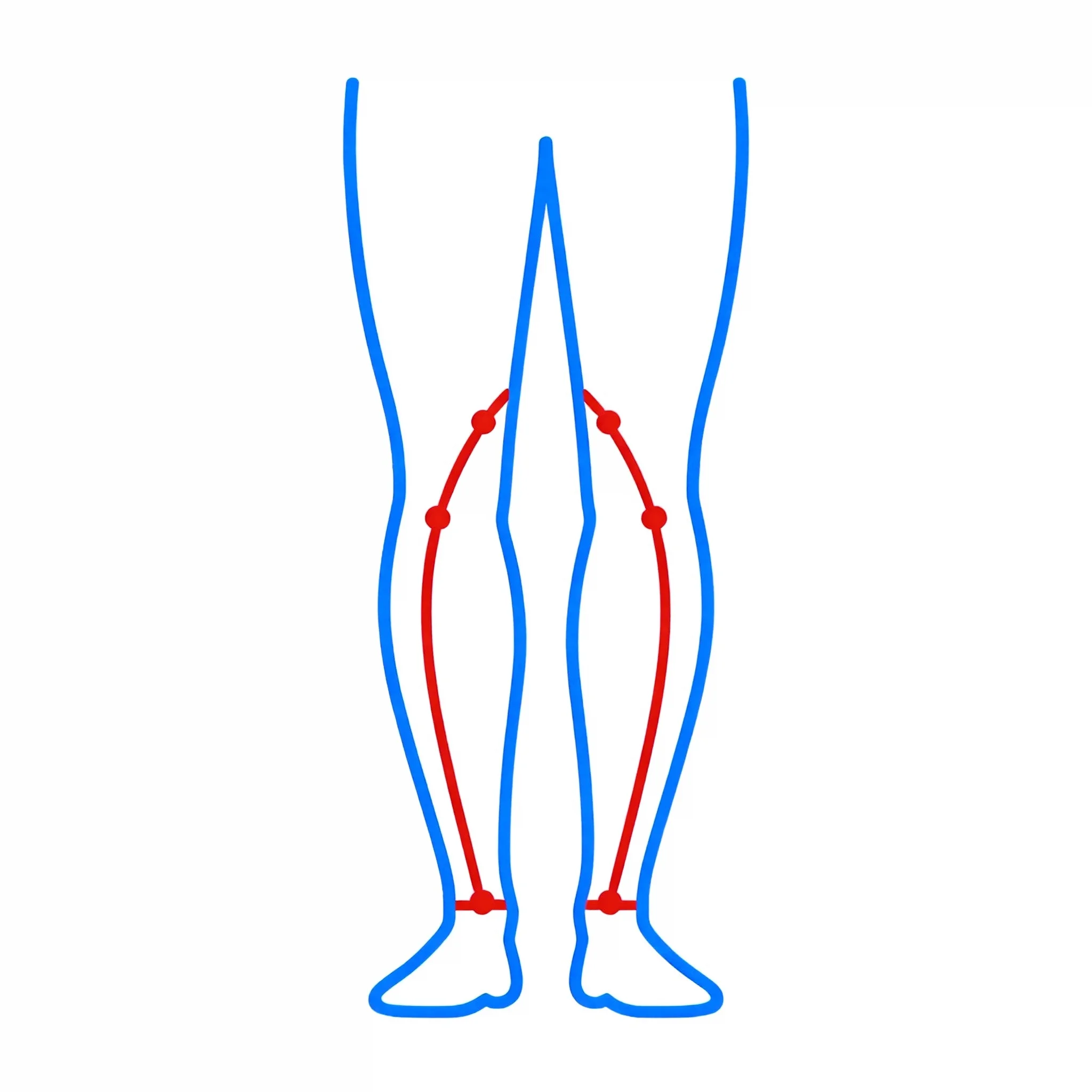 Bow Legs / Knock Knees