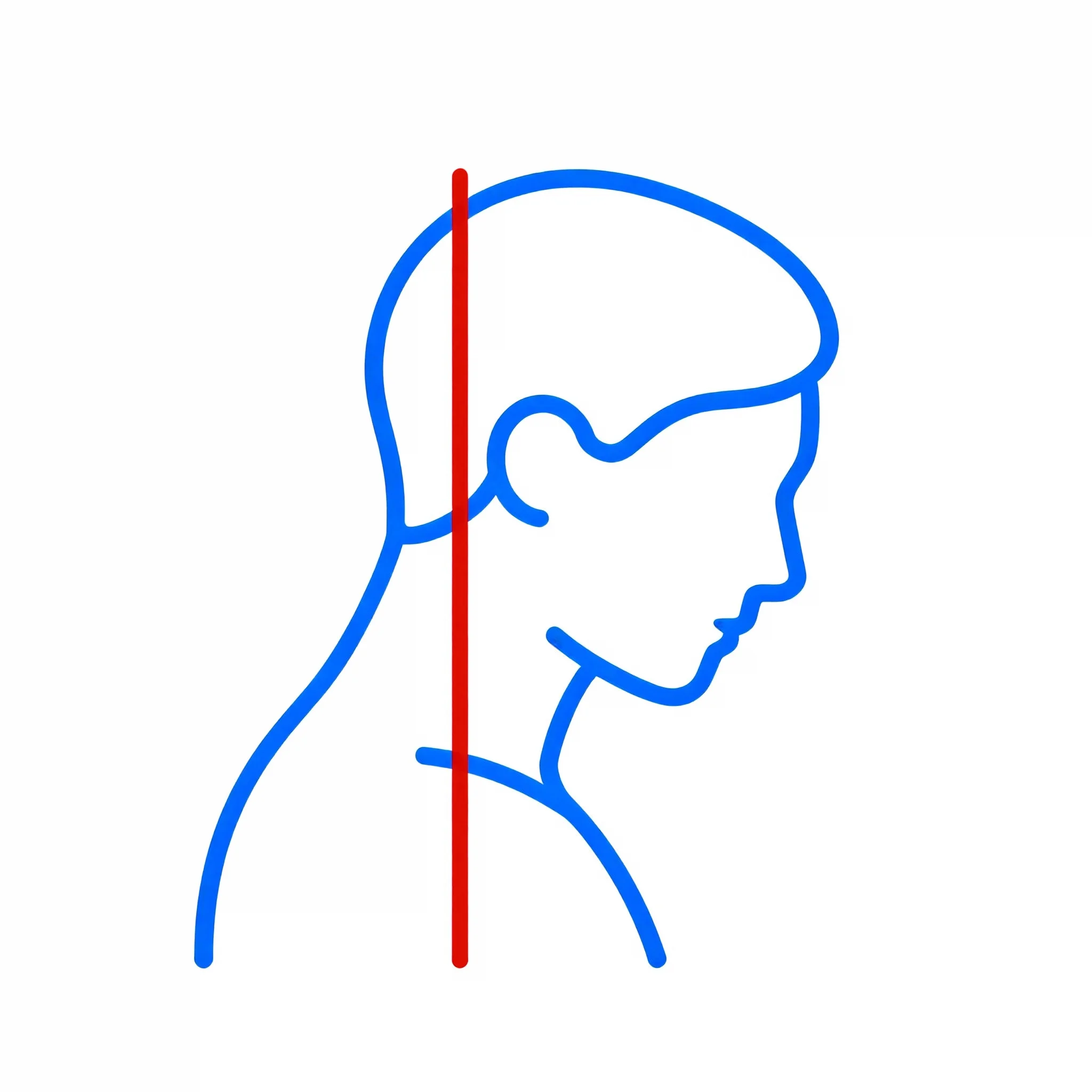 Forward Head Posture